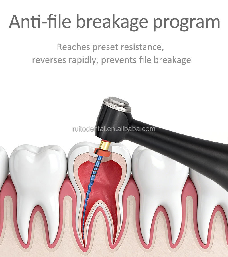 Dental Endo Motor Detail 2