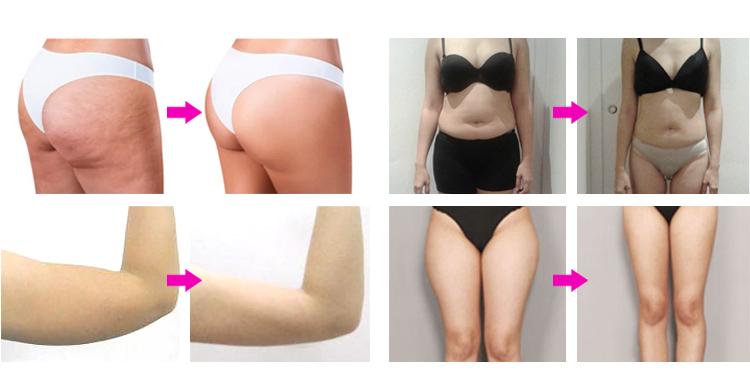 Before and After Treatment Effect 1