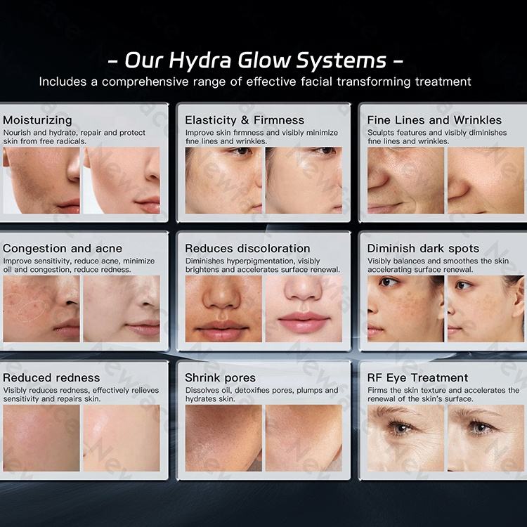 NewFace Professional Aesthetic 14-in-1 Hydrodermabrasion Facial Skincare Device Spa Machine