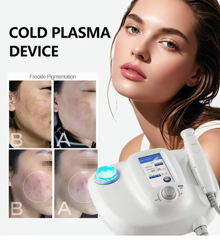 Portable Cold Plasma Beauty Machine for Acne Treatment Skin Tightening Whitening