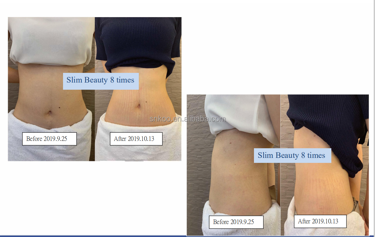 Treatment Process 1