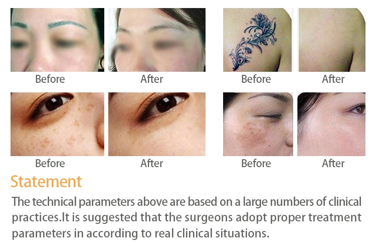 Before and after case 1