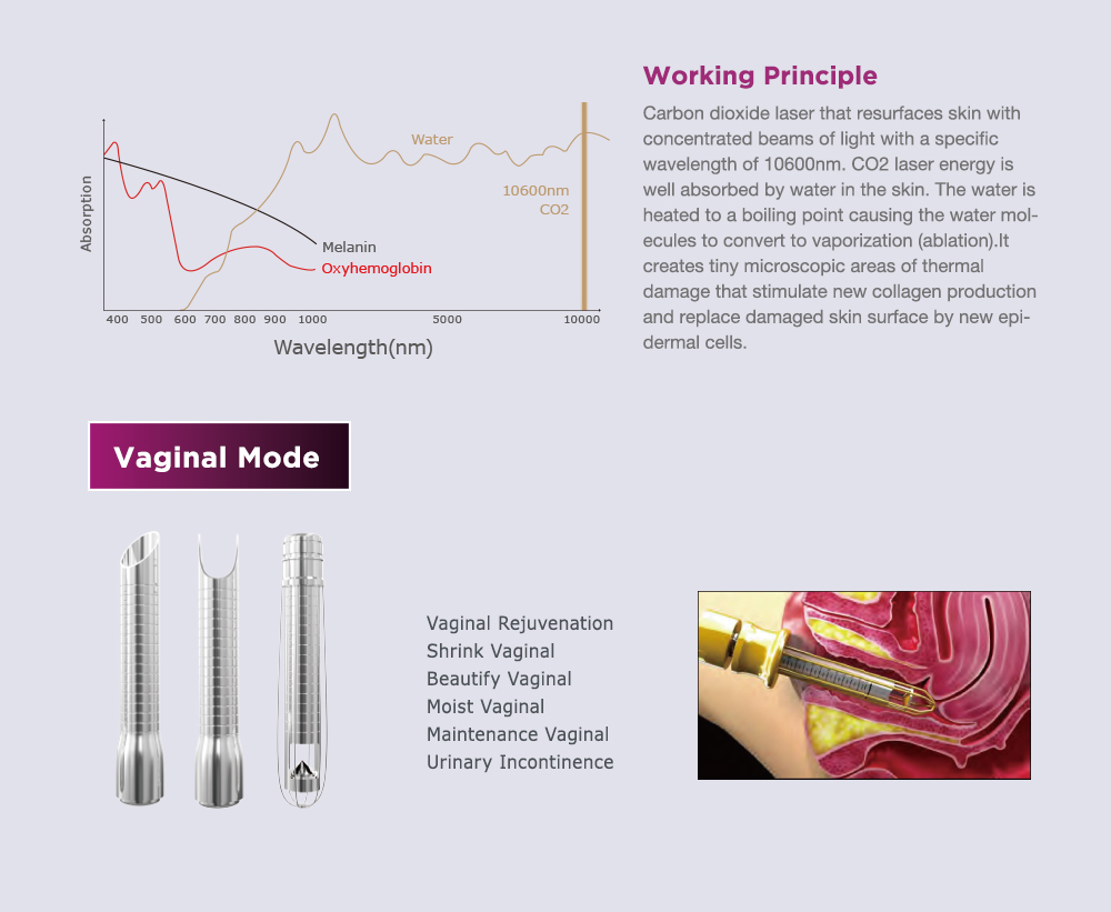 CO2 Fractional Laser Detail 4