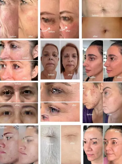 Before and After Treatment Effects