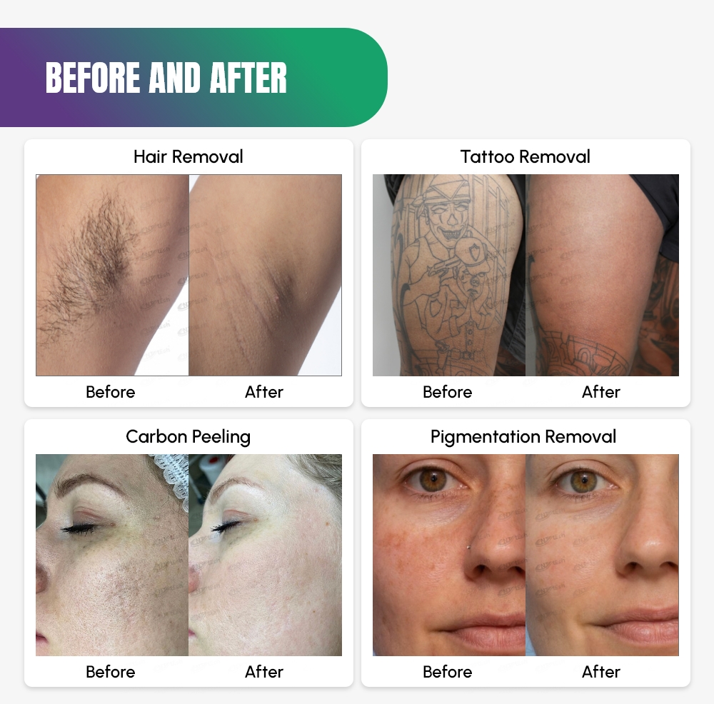 Treatment Results