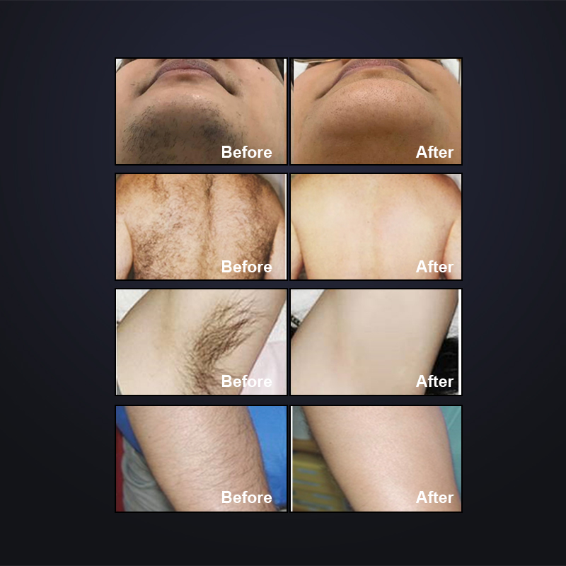 Treatment Results Charts