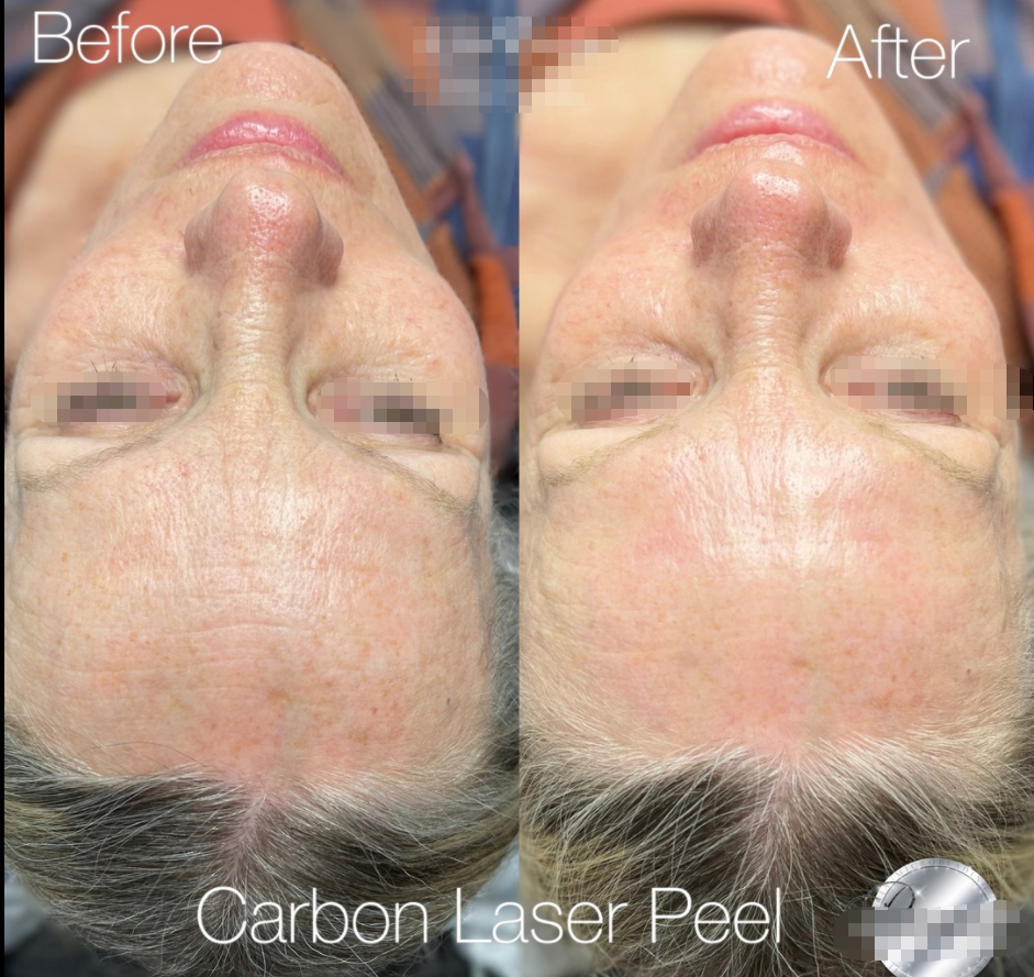 Before and after case 5