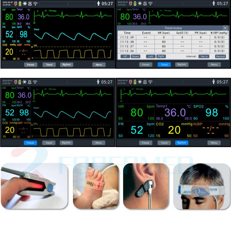 7'' Color Screen Portable Monitor Defbrillator ECG 6 Parameters Monitor Emergency Defbrillator