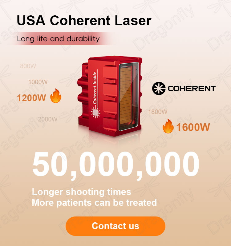 Laser Quality 1