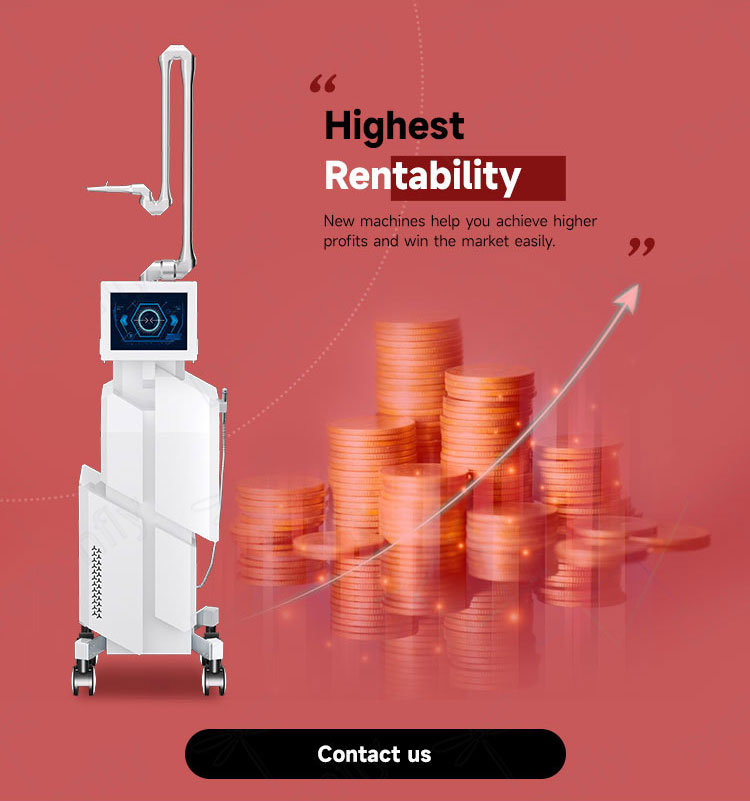 Rentability Chart