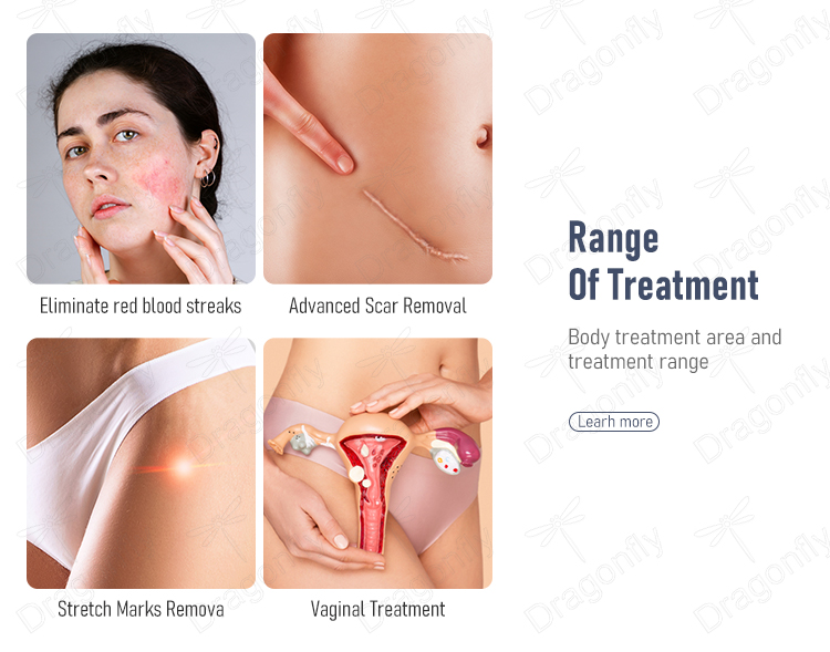 Treatment Detail 1