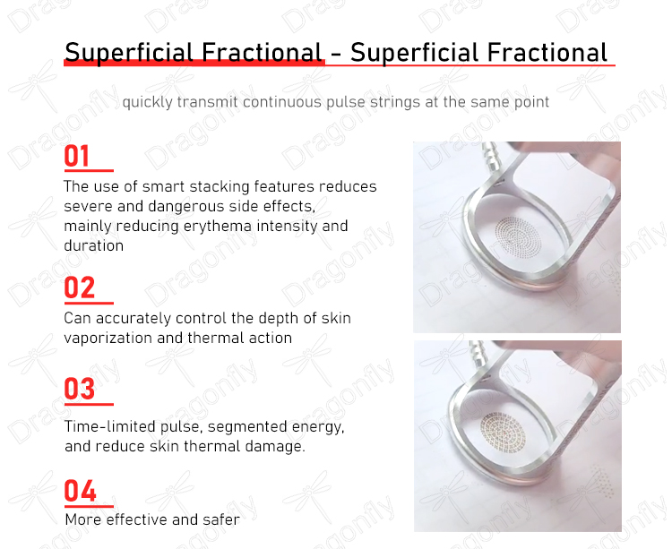Laser Product 08