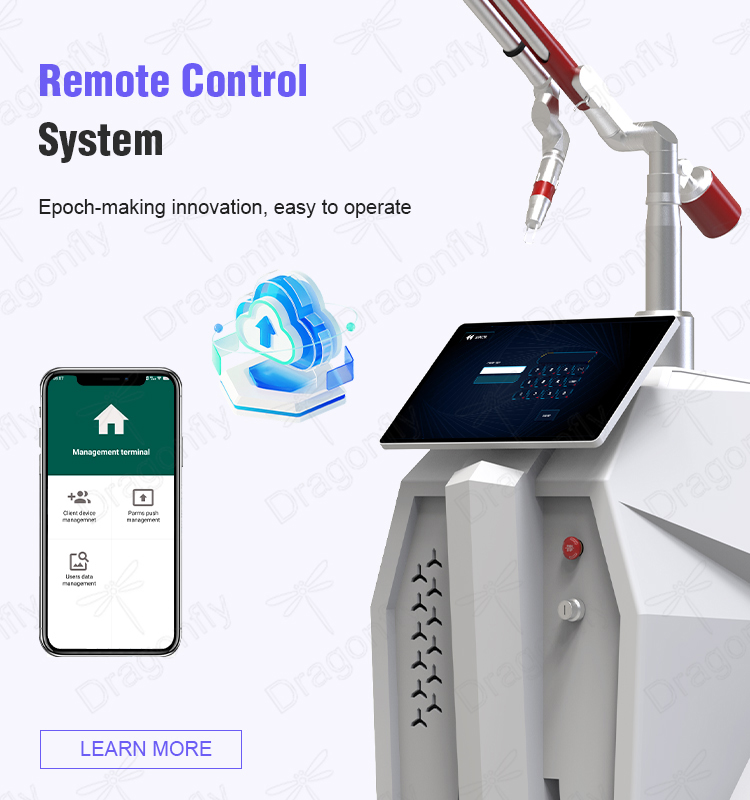 Remote Control