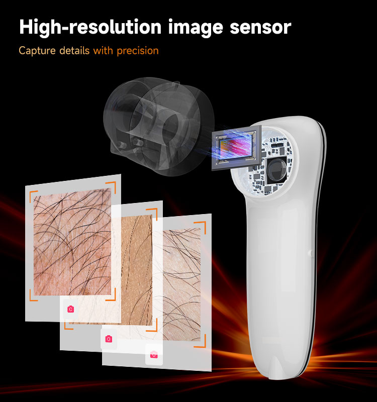 AI Skin Analysis