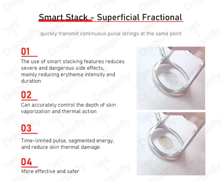 Core Component 5
