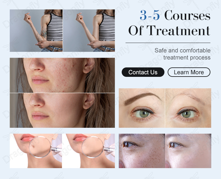 Skin Radiance Result