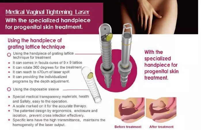 Picosecond Laser 1