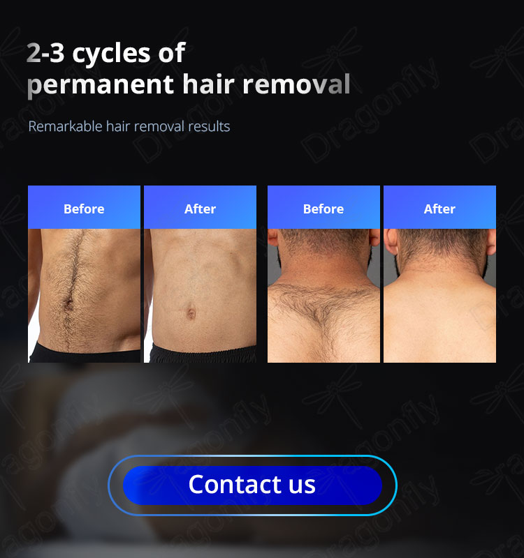 Treatment Results 1