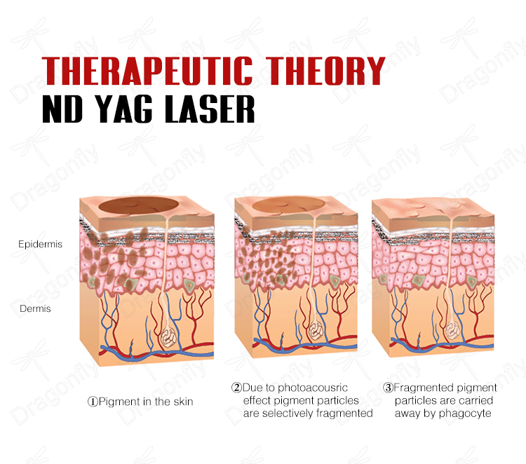 Treatment Process