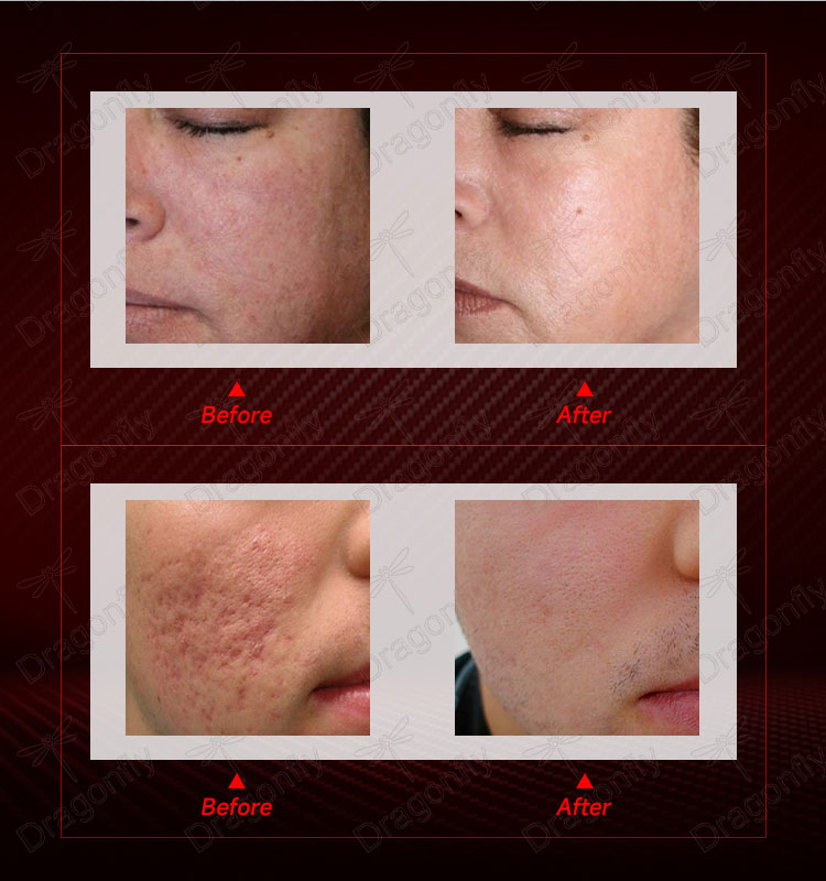 Treatment image