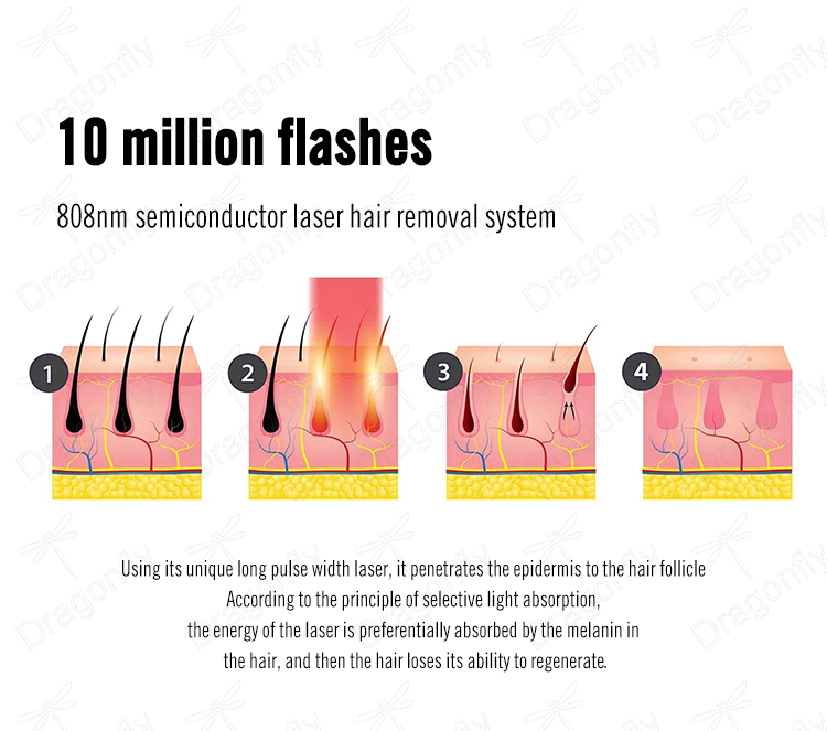 808 Diode Laser 04