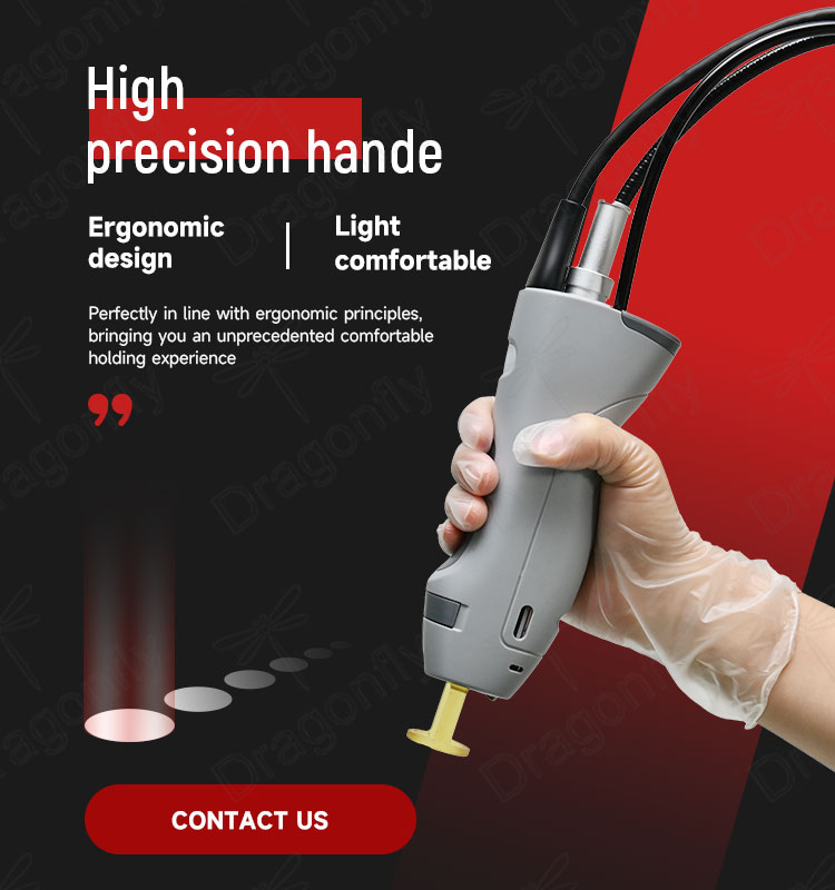 Handle Features