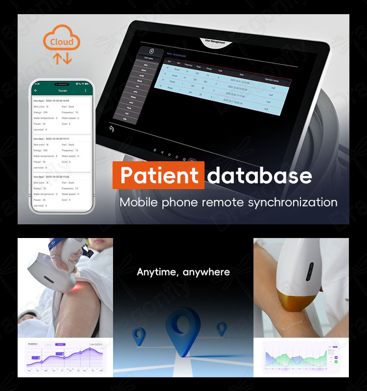 Database
