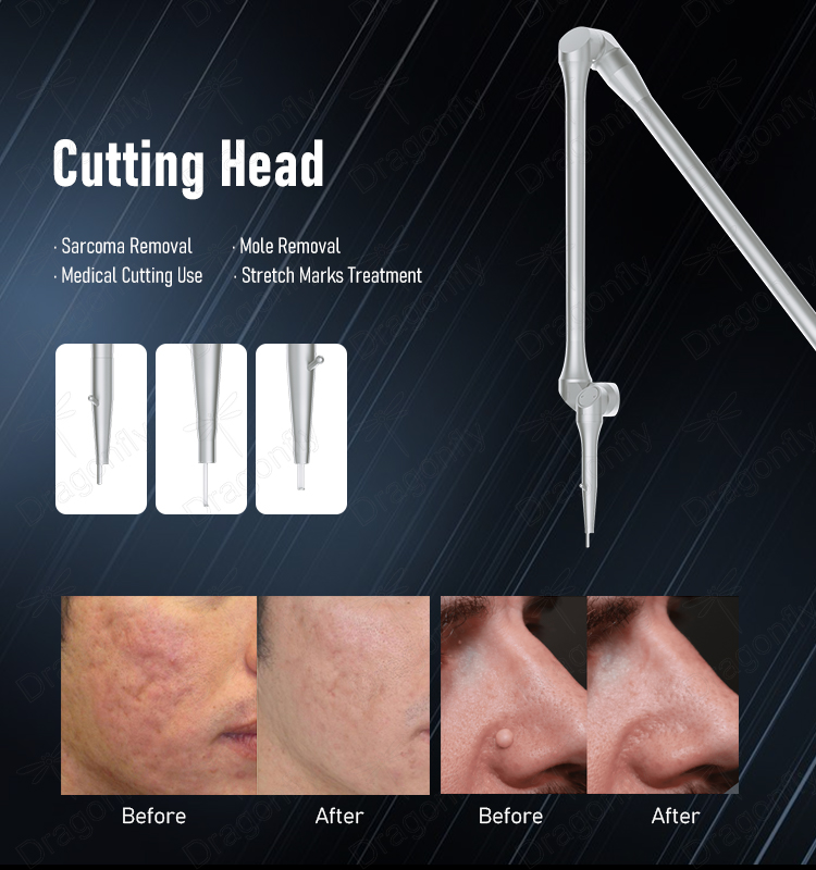 Treatment Detail 4