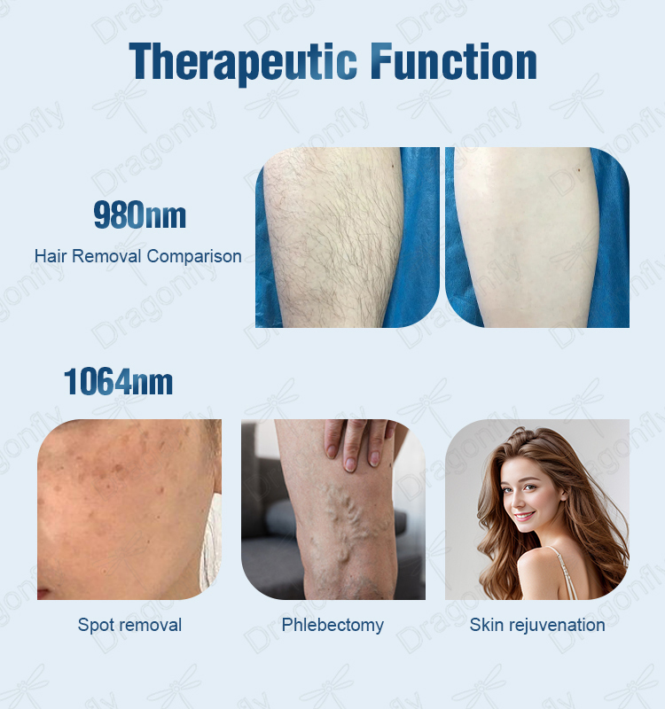 Treatment Result 2