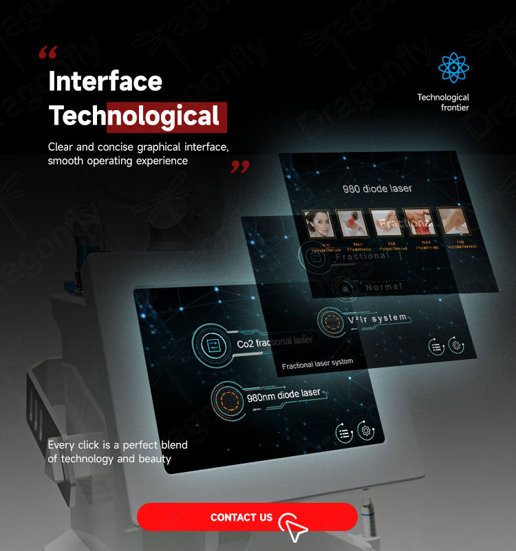 Operating Interface