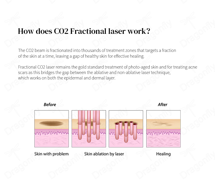 Treatment Results