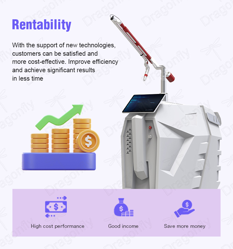 Laser Machine Features