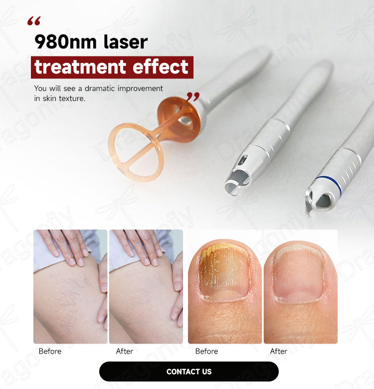 Treatment 3