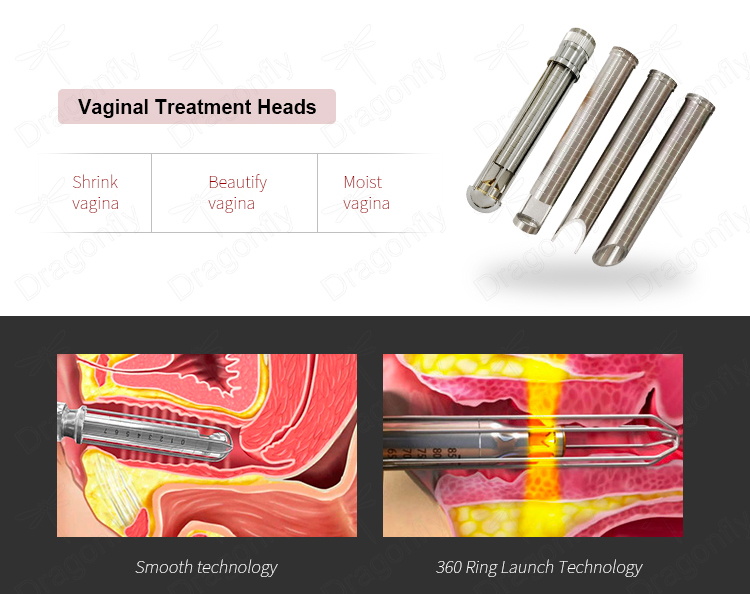 Handpiece Detail
