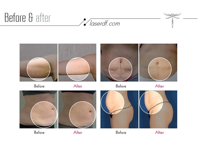 Product View 8