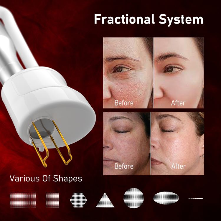ODM CO2 fractional laser machine scar removal vertical 980nm diode laser machine professional stretch mark removal Quotes, Products