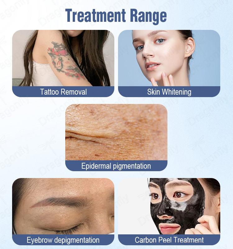 Carbon Facial