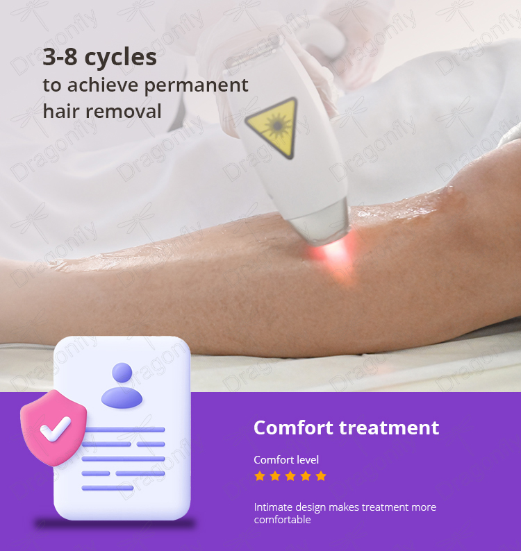 Laser hair removal 1