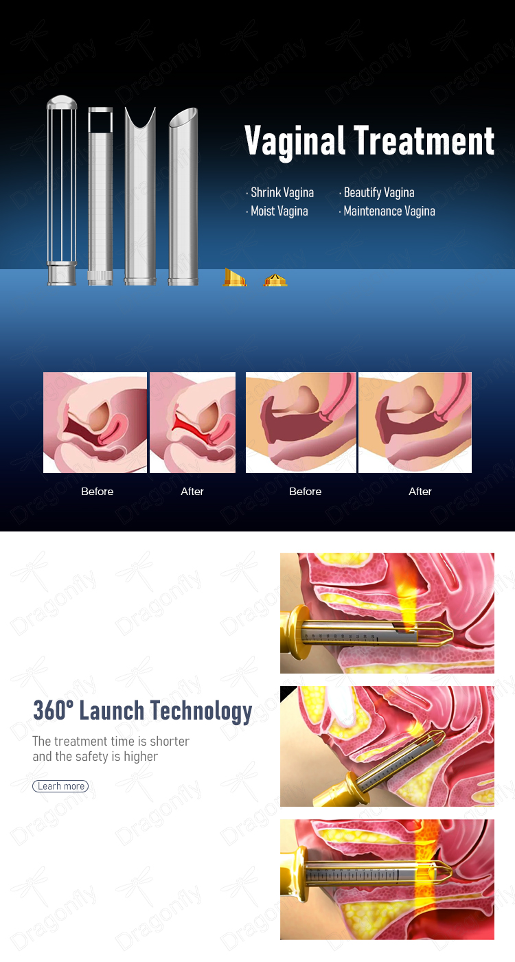 Treatment Detail 5