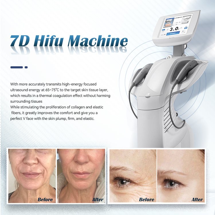 OEM Newest 7D HIFU Painless HI FU Machine Face Lifting Skin Tightenin Focused Ultrasound Anti-wrinkle Hifu 7D Machine Supplier, Suppliers