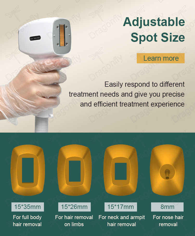 Laser Quality