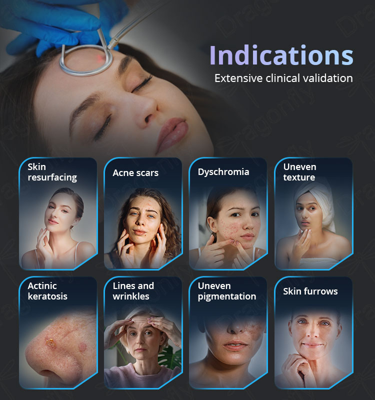 Device treatment