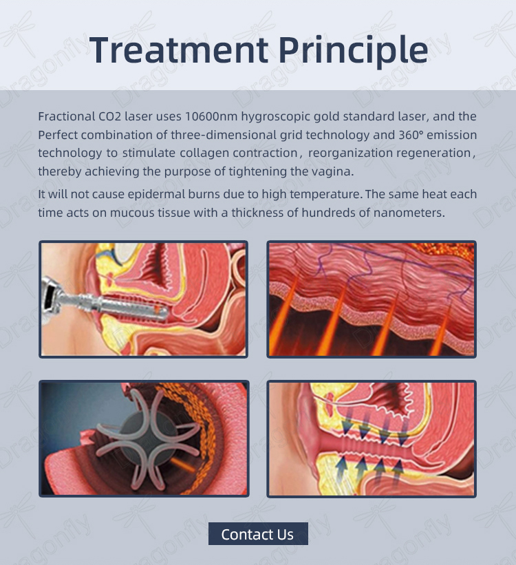 Fractional System