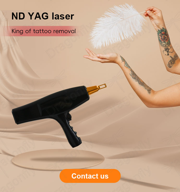 Nd Yag