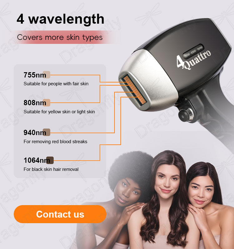 Laser Quality 2