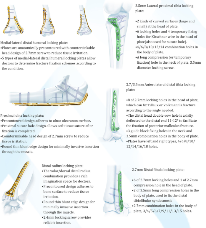 Reconstruction Clavicular Locking Plate II Product View 2