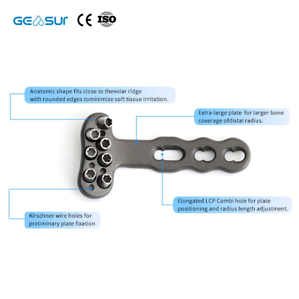 Geasure Distal Radius Locking Plate-Hospital Use Multiple Sizes Combi-Hole Design for Enhanced Fixation Flexibility 1 Year