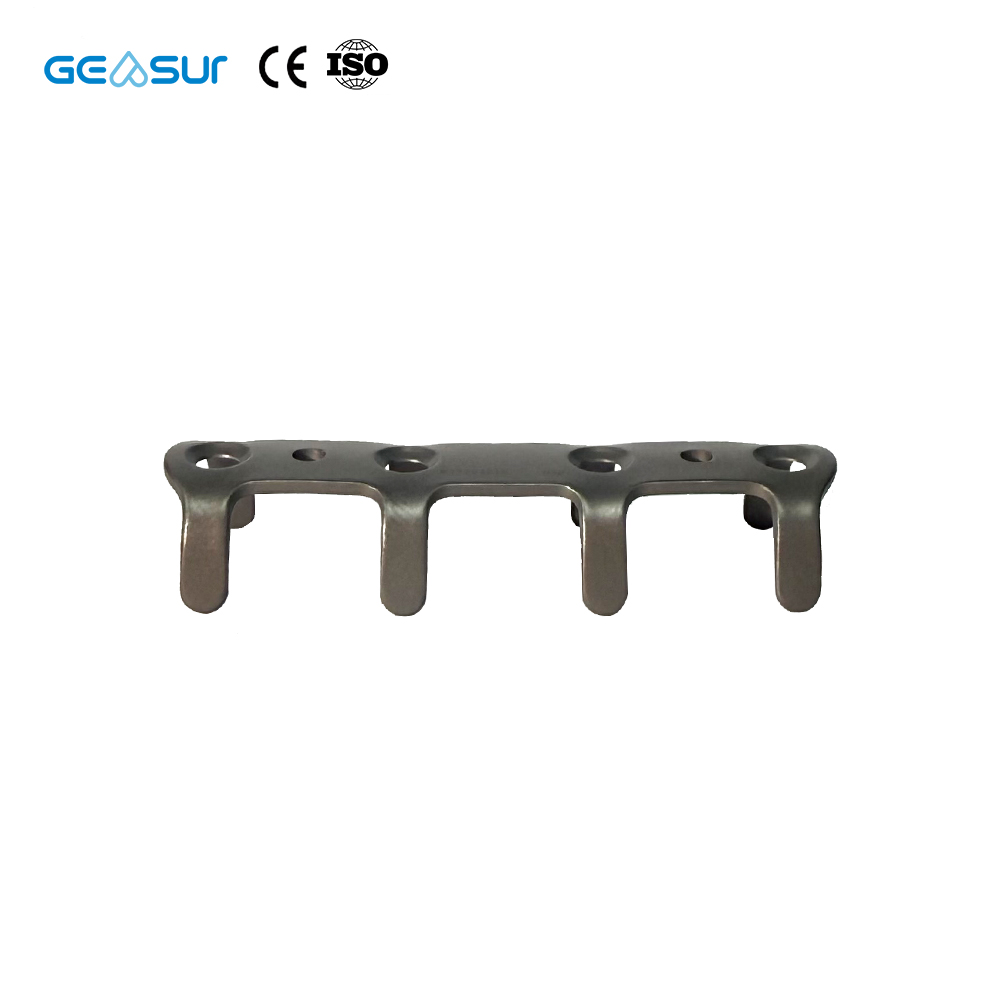 Geasure Titanium Alloy Rib Fixation Plate for Hospital Orthopedic Surgery-Optimized for Rapid Surgical Implantation Secure Bone