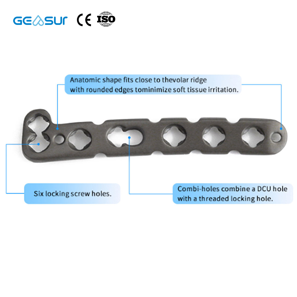 Geasure Distal Radius Locking Plate-Hospital Use Multiple Sizes Combi-Hole Design for Enhanced Fixation Flexibility 1 Year