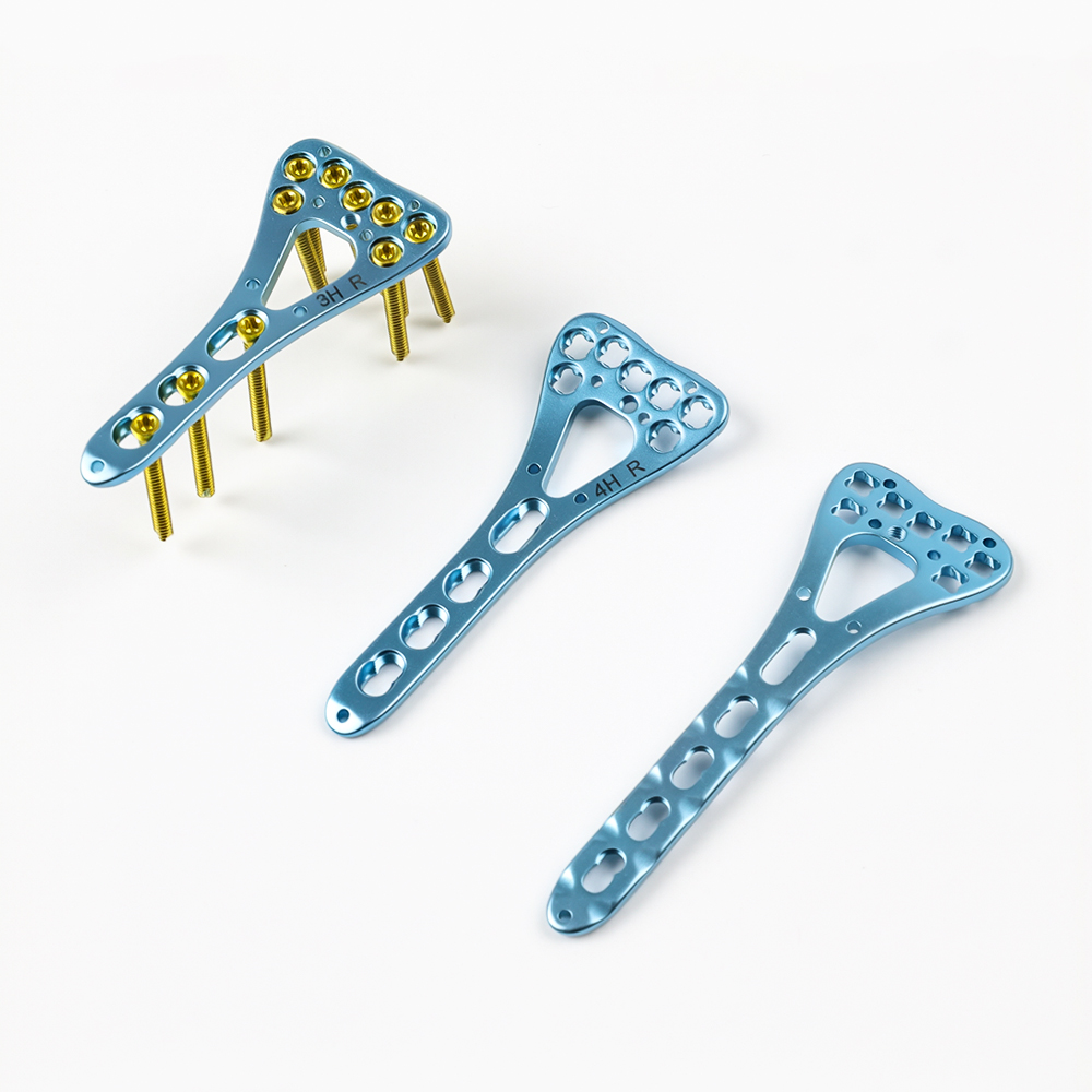 Distal Radius Medial Locking Plate for Orthopedic Trauma Implant, with Polyaxial Screw Holes for  Fracture Fixation.